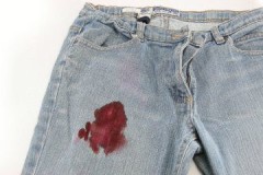 Methods and recipes on how to effectively remove blood on jeans